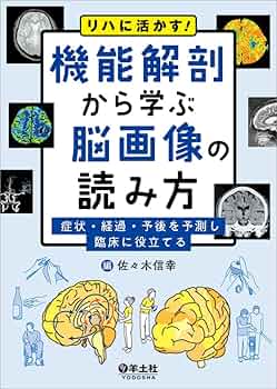 【DVD全２巻セット】リハビリテーションにおける脳画像の活用　●ジャパンライム DVD全2巻セット】リハビリテーションにおける脳画像の活用